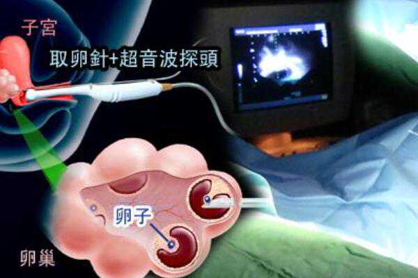 广州再找代孕得多少钱|宿州试管婴儿医院大全，2023
三代试管费用与成功率排名