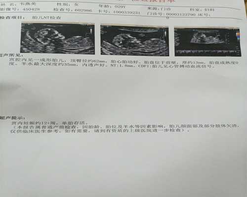 广州找代孕医院价格,试管婴儿可以找人代生吗-广州输卵管通而不畅检查要多少