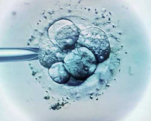 广州代生孩子选性别,广州哪些医院做试管婴儿,广州医院挂号网上预约平台