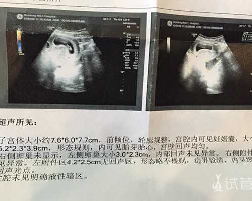 广州代怀小孩,广州慈孕试管医院怎么去_广州供卵机构知名坤和助孕