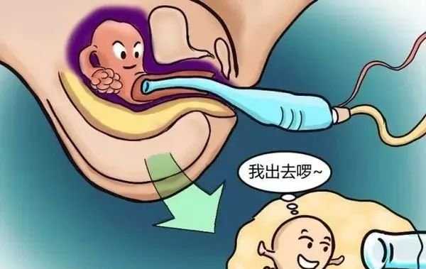 广州传承助孕生殖中心[供卵哪个医院好]+泰国试管婴儿流程是怎样的？需要提前