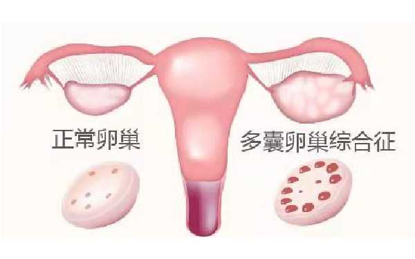 广州代生宝宝 广州广医三院试管婴儿成功率大概多少? ‘b超单男宝孕囊’